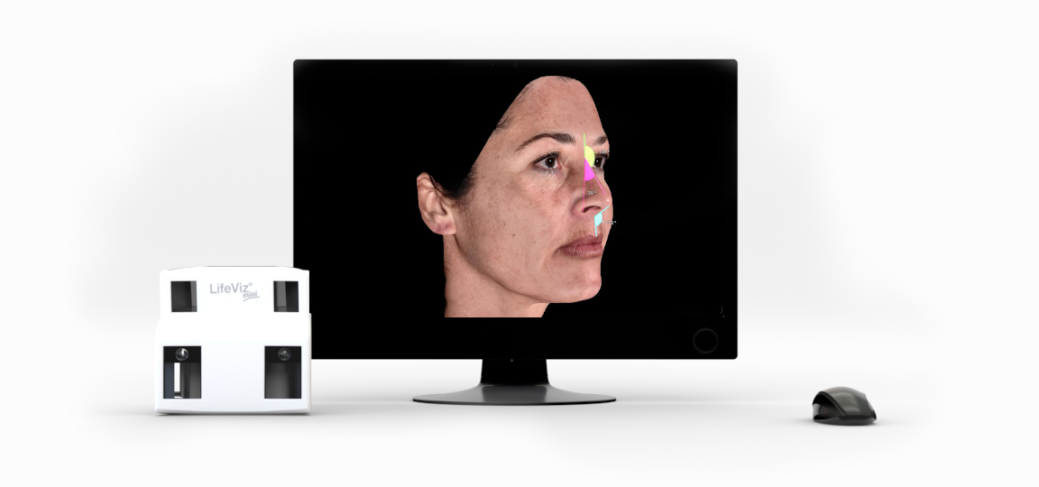 3D hudanalys med LifeViz Mini